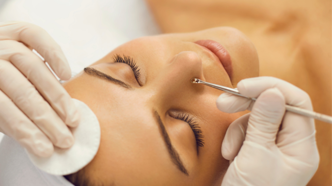 Limpeza de Pele para Acne: Quando Fazer e Quando Evitar